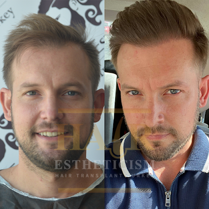 Hair Estheticism Hair Transplant Turkey | Transplante de Cabelo Turquia | Injerto Capilar Turquia main image